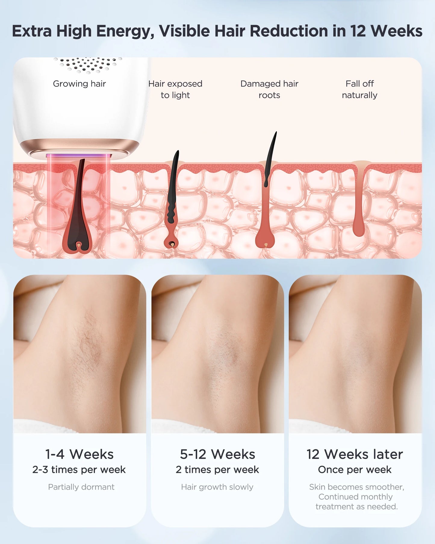 Innza IPL Hair Removal Device Painless Permanent Ice Cooling Care
